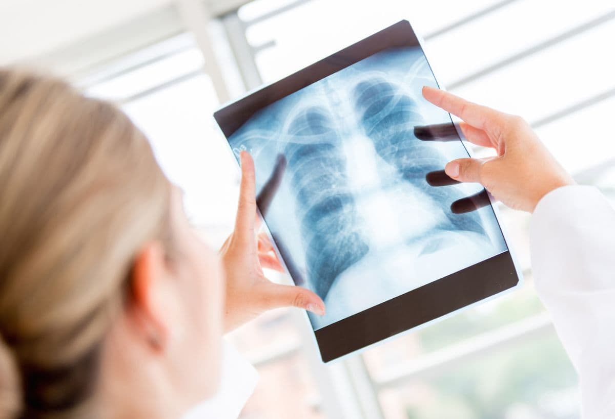 Illustration GHT : et la radiologie, on en parle ?